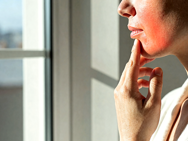 Bioderma and Acids: What to Check If Your Skin Feels Dehydrated