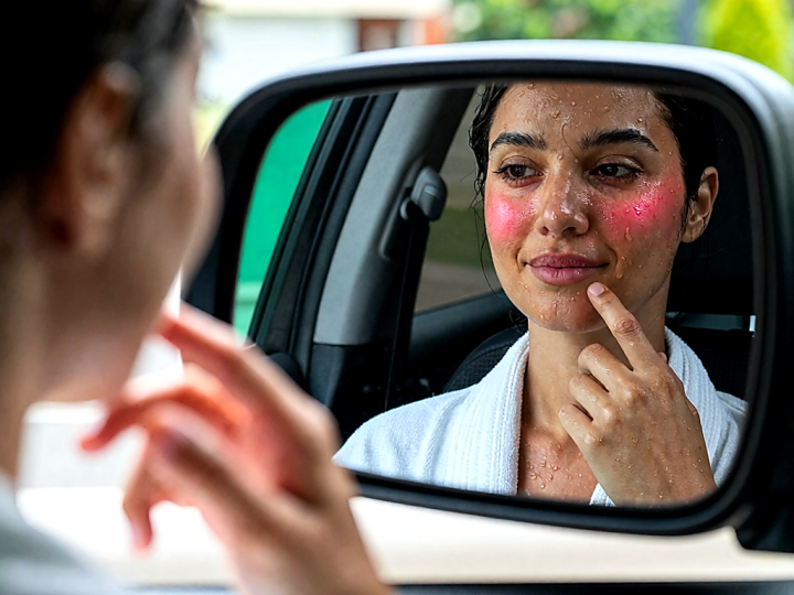 Vichy и SPF: что важно проверить, если беспокоит сухость